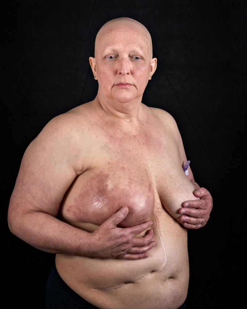 Denise Bates